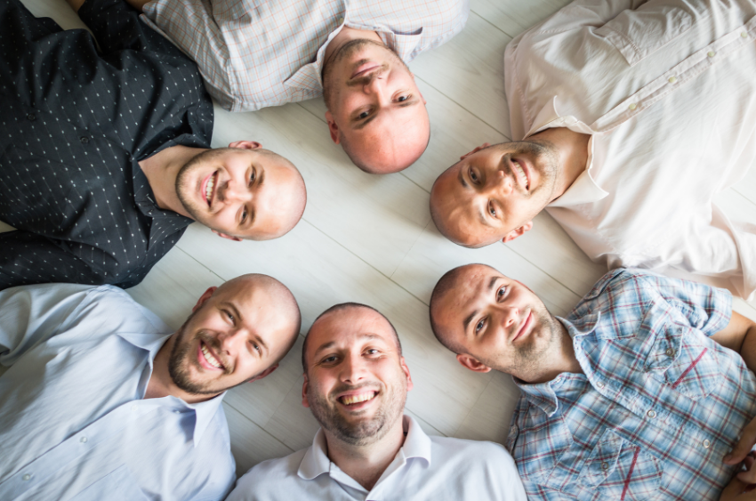 Face The Facts About DHT & Hair Thinning