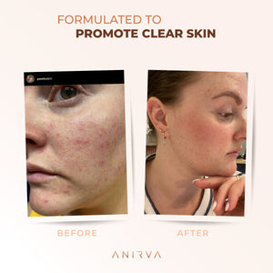 ClearDerm with Probiotics