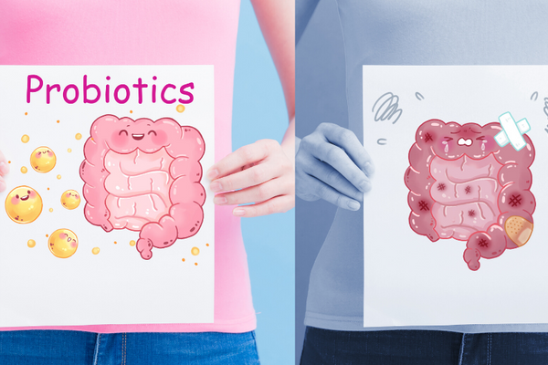 prebiotics vs probiotics