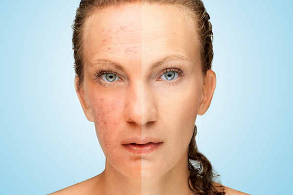 benefits of selenium