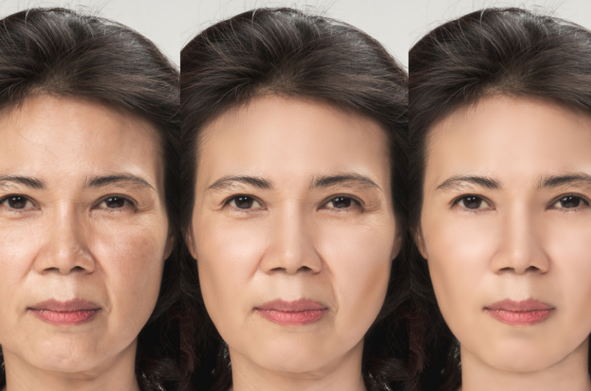 Do Collagen Supplements Actually Do Anything?