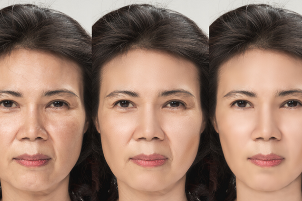 Do Collagen Supplements Actually Do Anything?