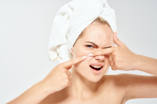 Best Probiotic for Hormonal Acne