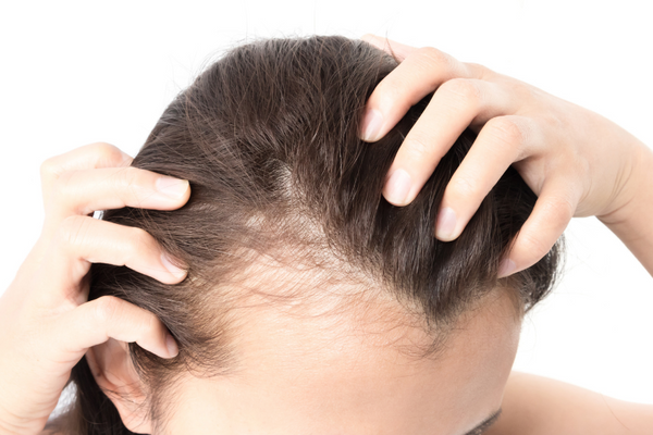 5 Reasons You're Losing Your Locks